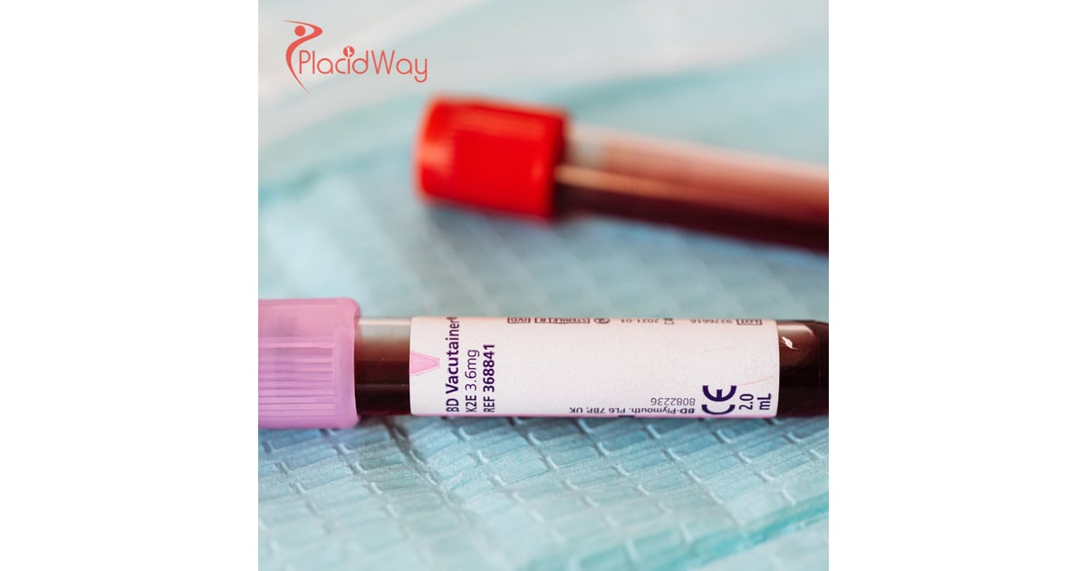 What to Expect from Stem Cell Treatments Abroad: Costs, Risks, and Recovery