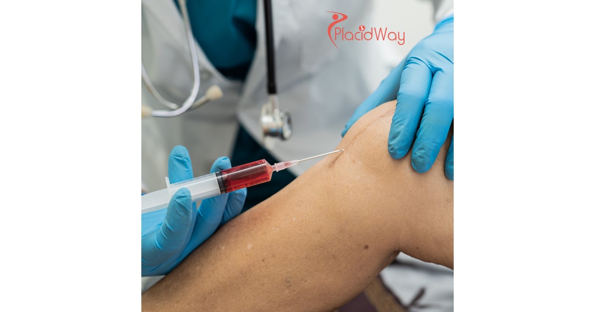 Stem Cell Treatment for Osteoarthritis: Safe, Affordable Solutions for Joint Pain