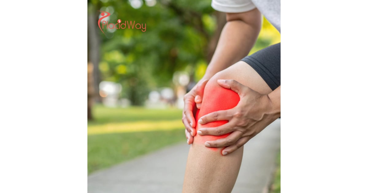 Stem Cell Therapy for Knee Osteoarthritis in Mexico: A Complete Guide