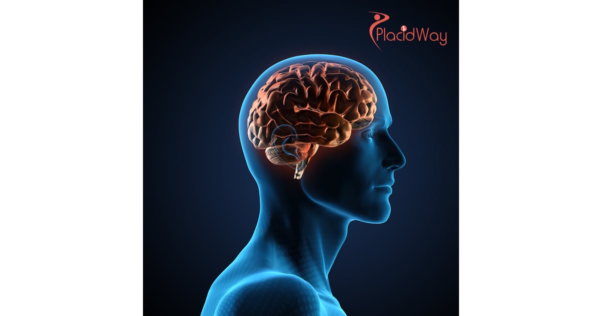 Brain Injury Stem Cell Therapy in Mexico: The Ultimate Guide for Medical Tourists