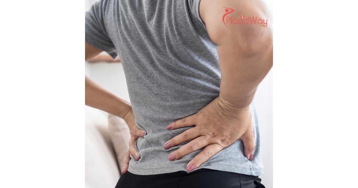 Terapia con células madre para hernia discal en México: La guía definitiva