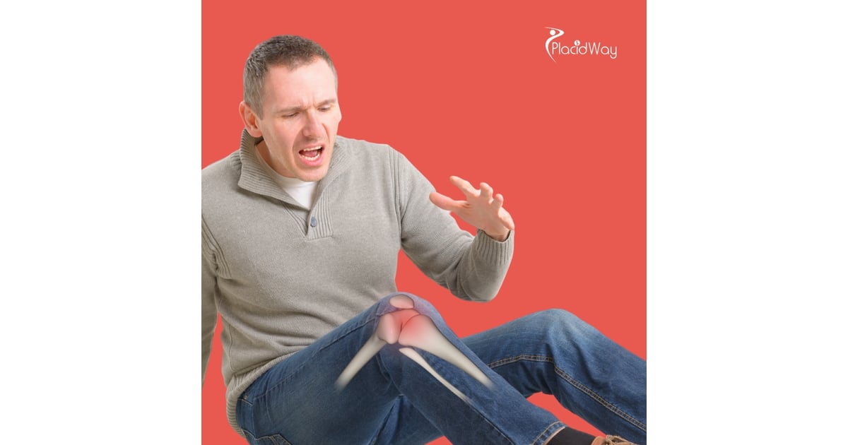 Stem Cell Therapy for Knee Osteoarthritis in Mexico: Brazilian Patient Guide