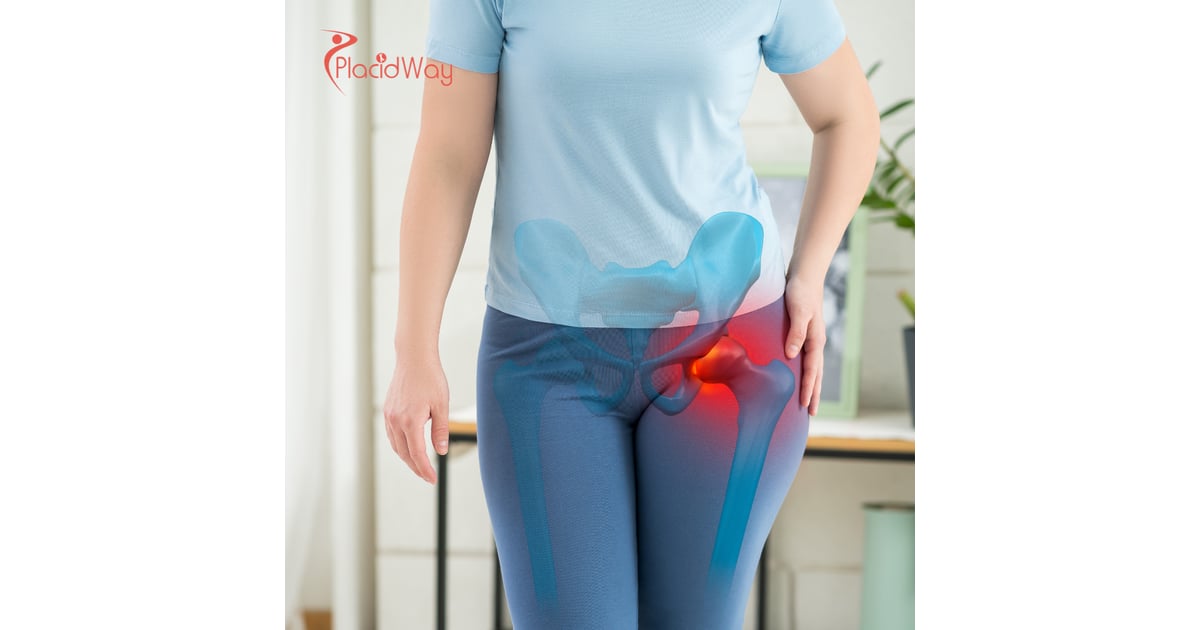 Hip Regeneration Stem Cell Therapy in Thailand: The Complete Guide