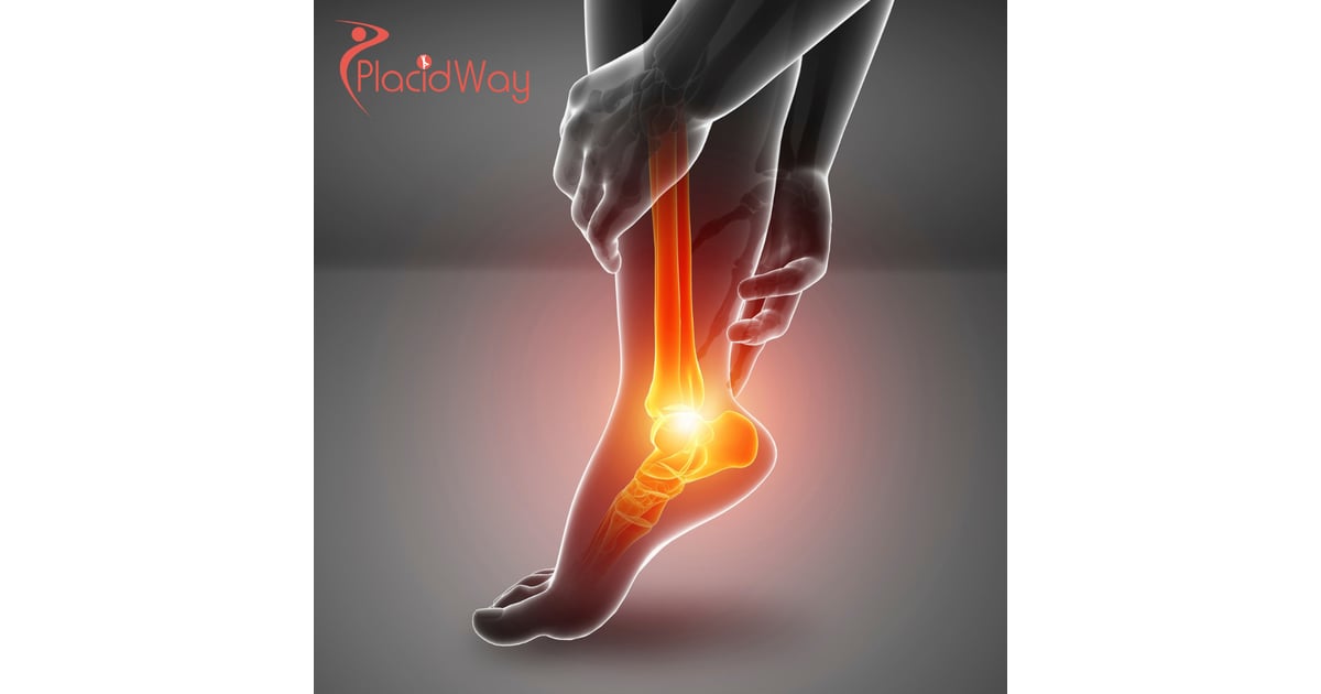 Orthopaedic Stem Cell Therapy in Colombia: The Definitive Guide to Regenerative Joint Health