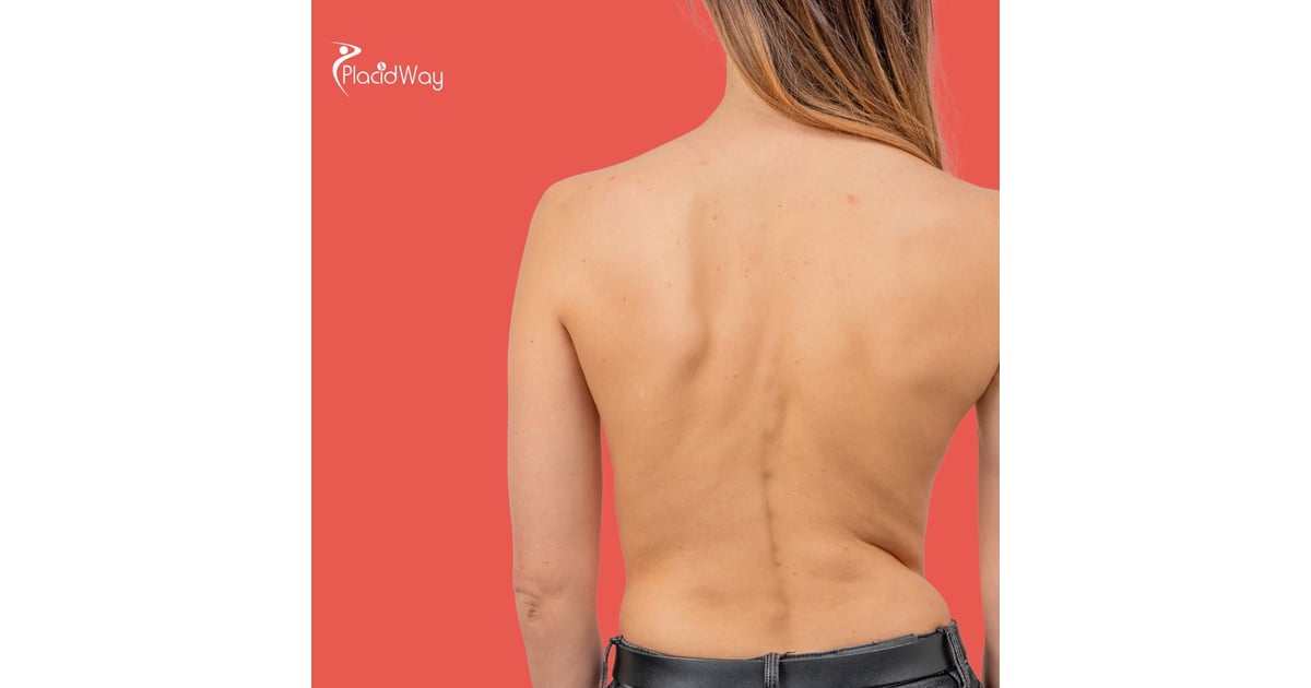 Restoring Movement Without Surgery: Argentina’s Spine Stem Cell Solutions for Miami Patients