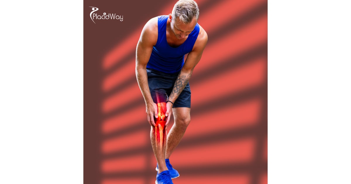 Osteoarthritis Stem Cell Therapy in Mexico for Patients from Central America Seeking Relief and Renewal