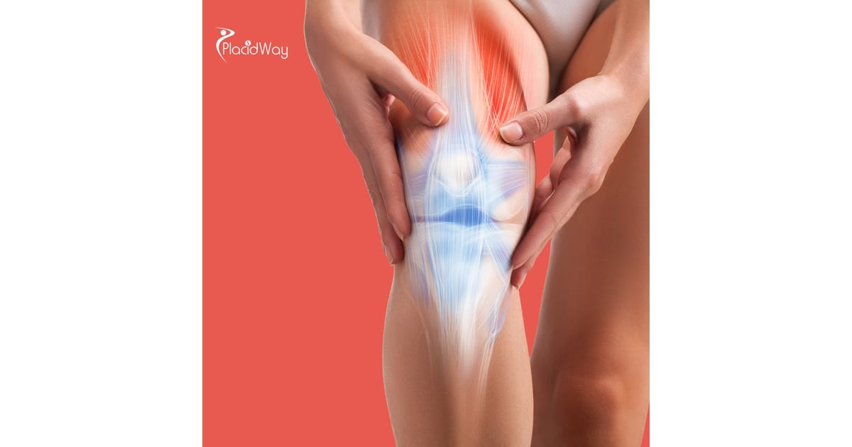 Osteoarthritis Stem Cell Therapy in Thailand: Key Information for Bangladeshi Patients