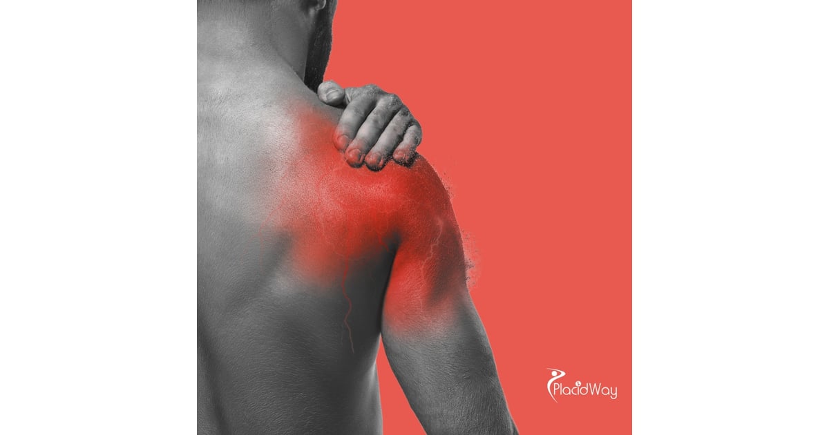 Restoring Shoulder Mobility: A Berlin Patient’s Guide to Stem Cell Therapy in Greece