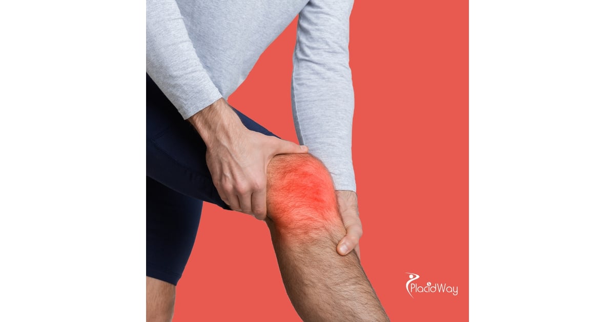 Knee Regeneration with Stem Cells in Thailand: A Practical Guide for Singaporean Patients
