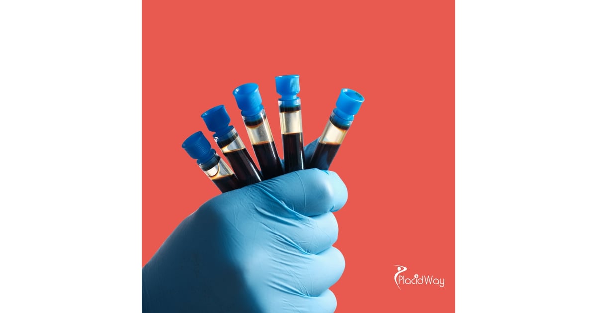 Restoring Strength and Wellness: Why Nigerian Patients Choose the UAE for PRP Stem Cell Therapy