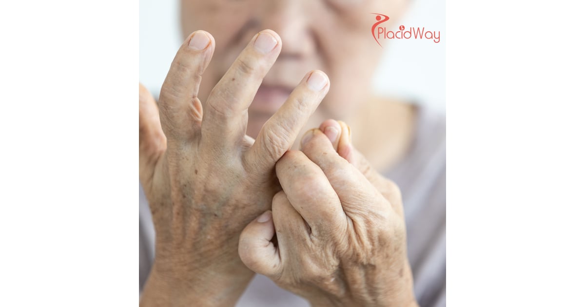 Stem Cell Therapy for Rheumatoid Arthritis in India: A Guide to Costs & Care