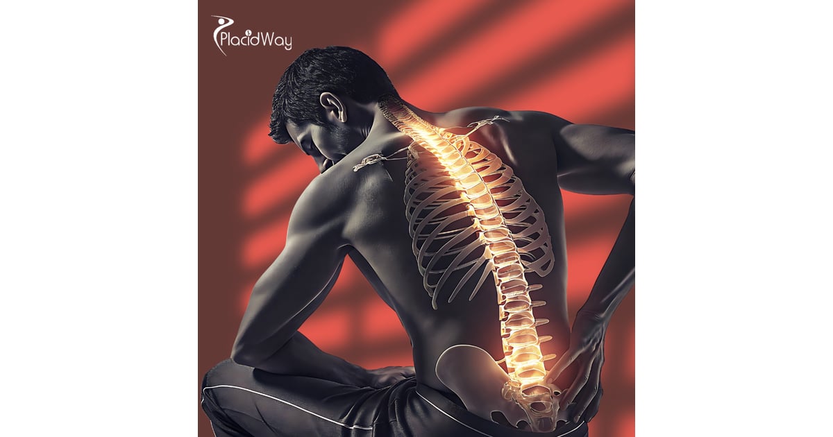 Spine Arthritis Stem Cell Therapy in Mexico for Patients from Brazil Wanting to Move Without Pain