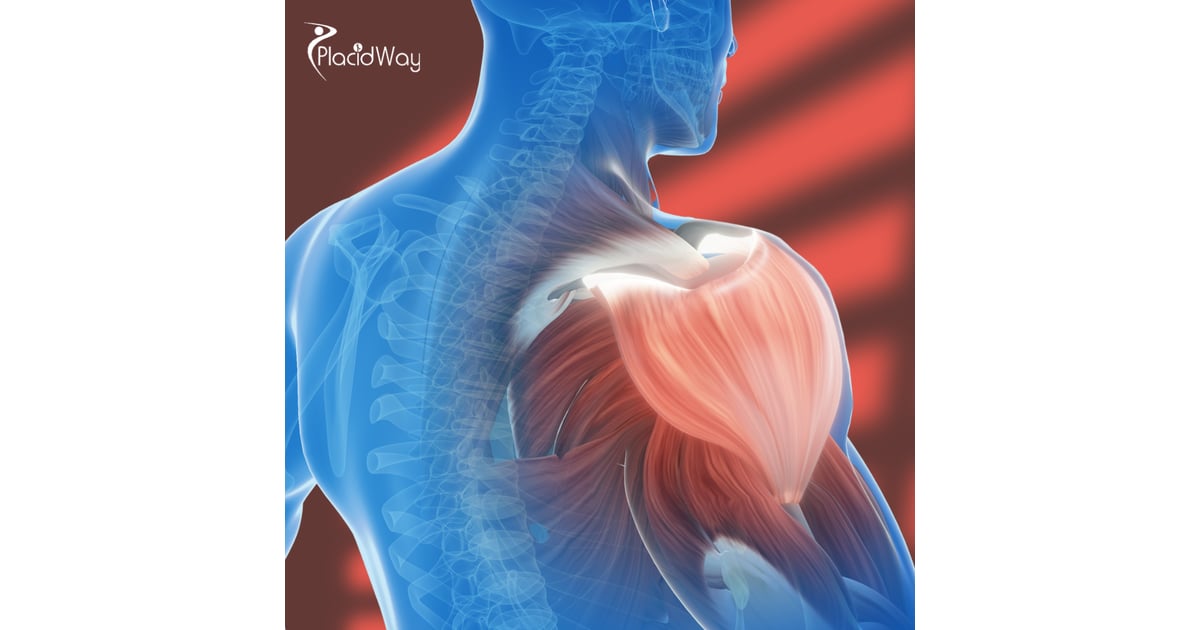 Rotator Cuff Tear Stem Cell Therapy in the Dominican Republic for Patients from Canada Looking to Regain Strength