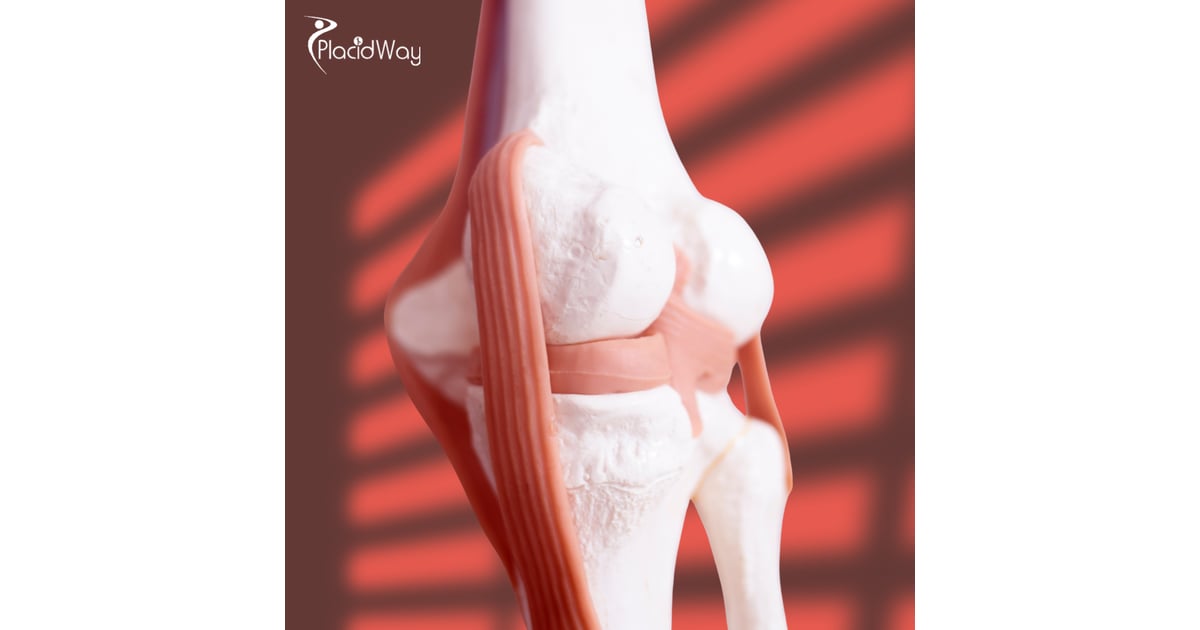 Meniscus Tear Stem Cell Therapy in Thailand Bringing Relief to Patients from Kuwait