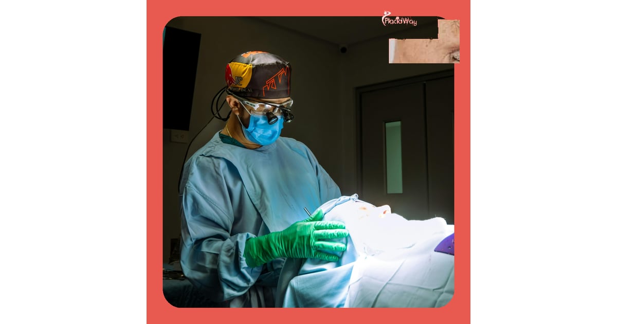 Rhinoplasty in Turkey for Berlin Patients Refining Facial Profile 
