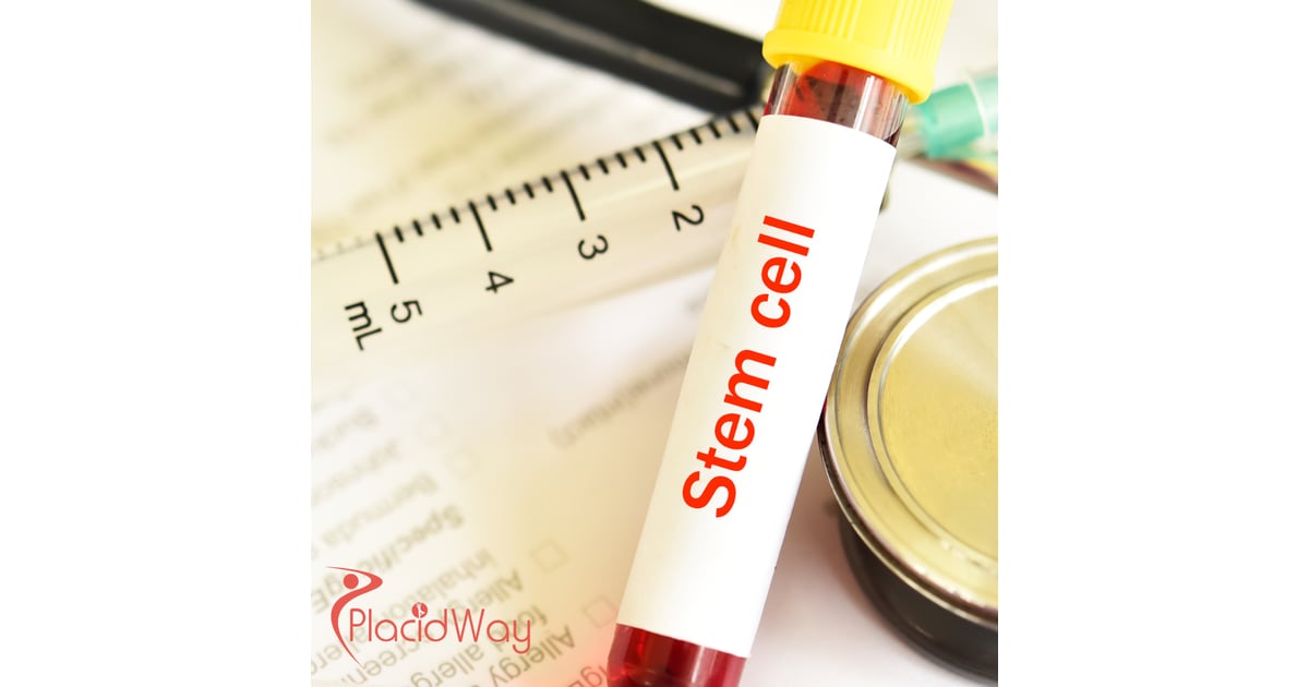 Affordable Stem Cell Treatment in Mexico for German Patients Exploring Non-Surgical Options