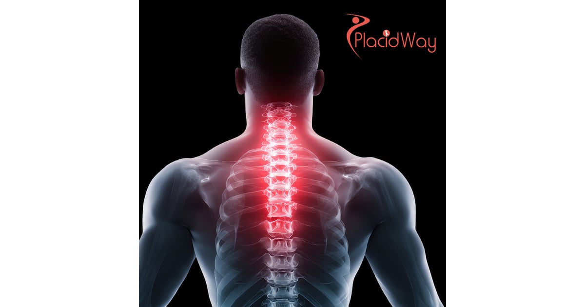 Stem Cell Therapy for Back Pain in Thailand for US Patients With Chronic Spine Issues