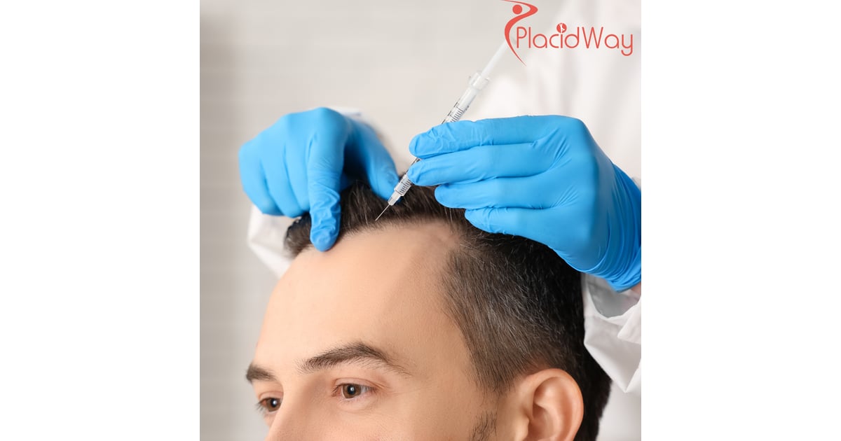DHI Hair Transplant in Turkey for American Professionals