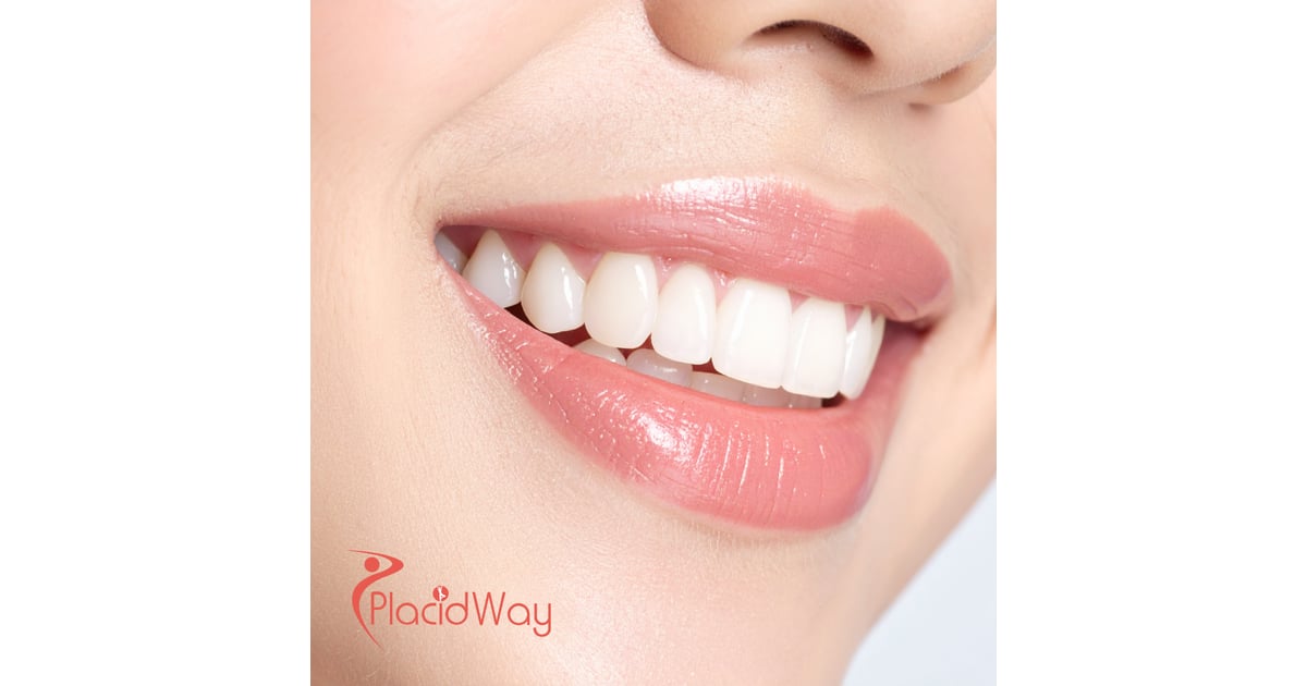 Cosmetic Dentistry in Turkey for Toronto & Markham Patients