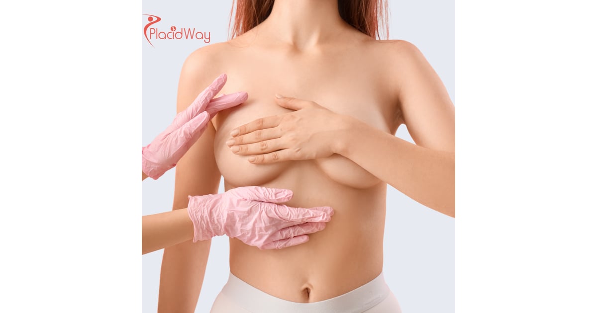 Breast Augmentation in Mexico for Toronto Patients Looking for Affordable Implants