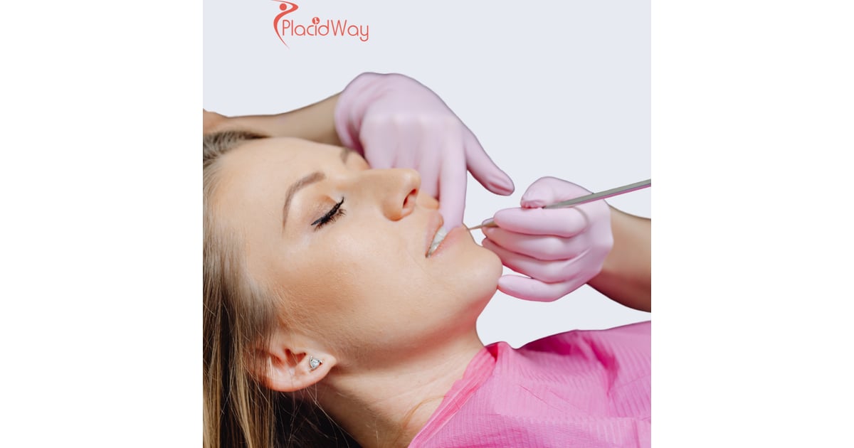 Dental Implants in Turkey for London Patients Facing High Private Dental Costs