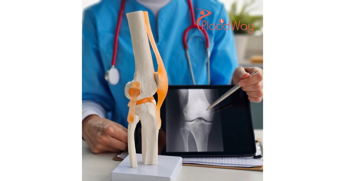 Knee Replacement Surgery in India for Bangladeshi Patients