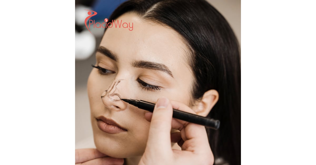 Revision Rhinoplasty in South Korea for Chinese Patients