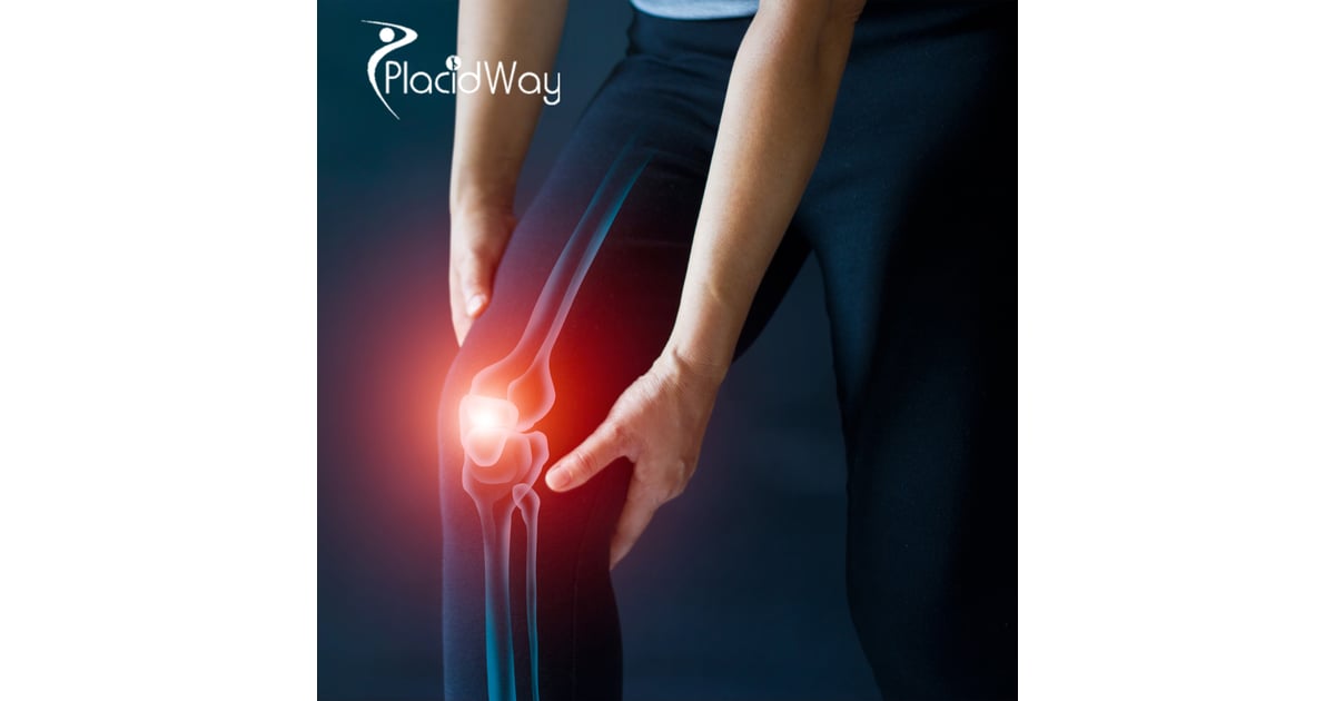 Stem Cell Therapy in Japan for Knee Arthritis Patients Considering Advanced Non-Surgical Options