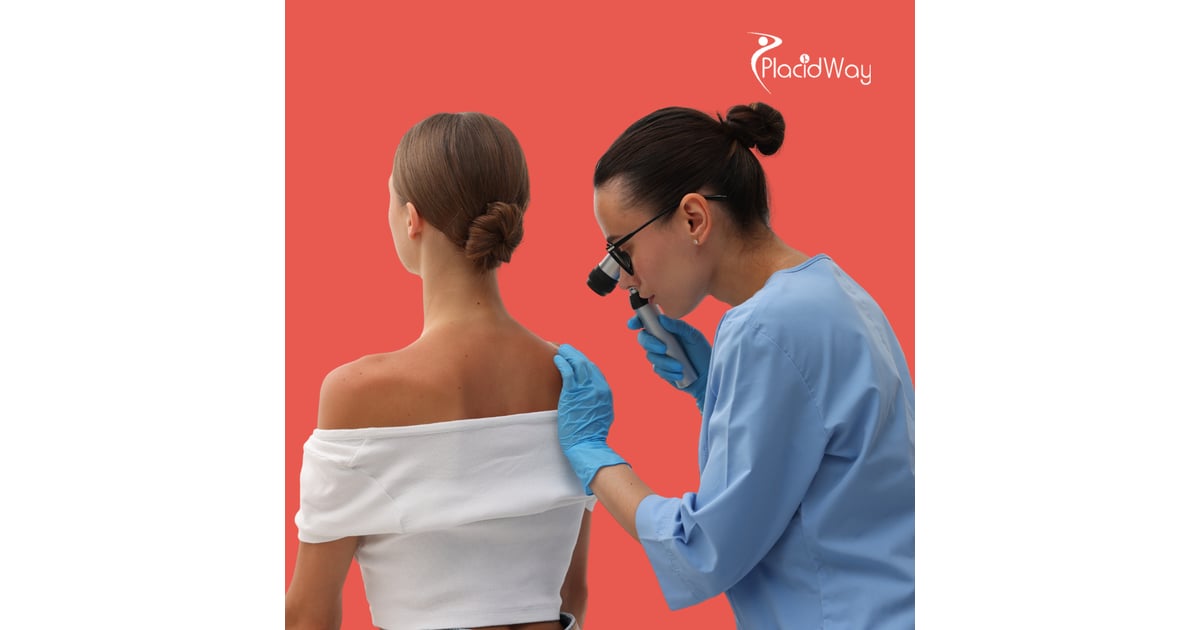 Melanoma Immunotherapy in Mexico: Trends, Patient FAQs, and Success Stories