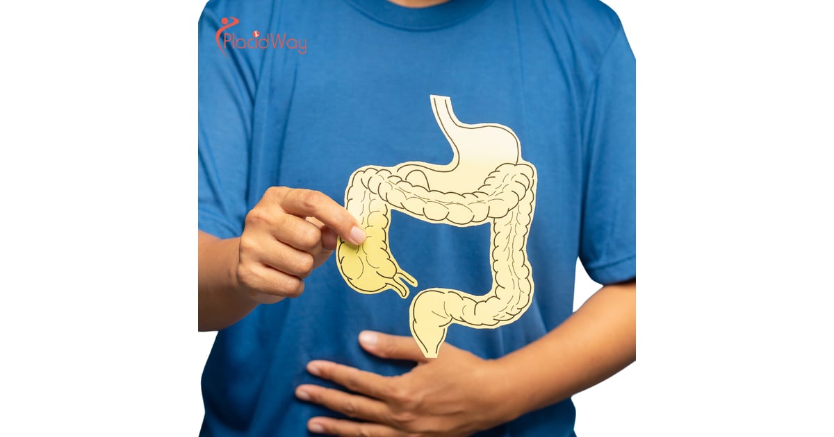 Alternative Colon Cancer Treatment in Tijuana - Can You Avoid Permanent Colostomy