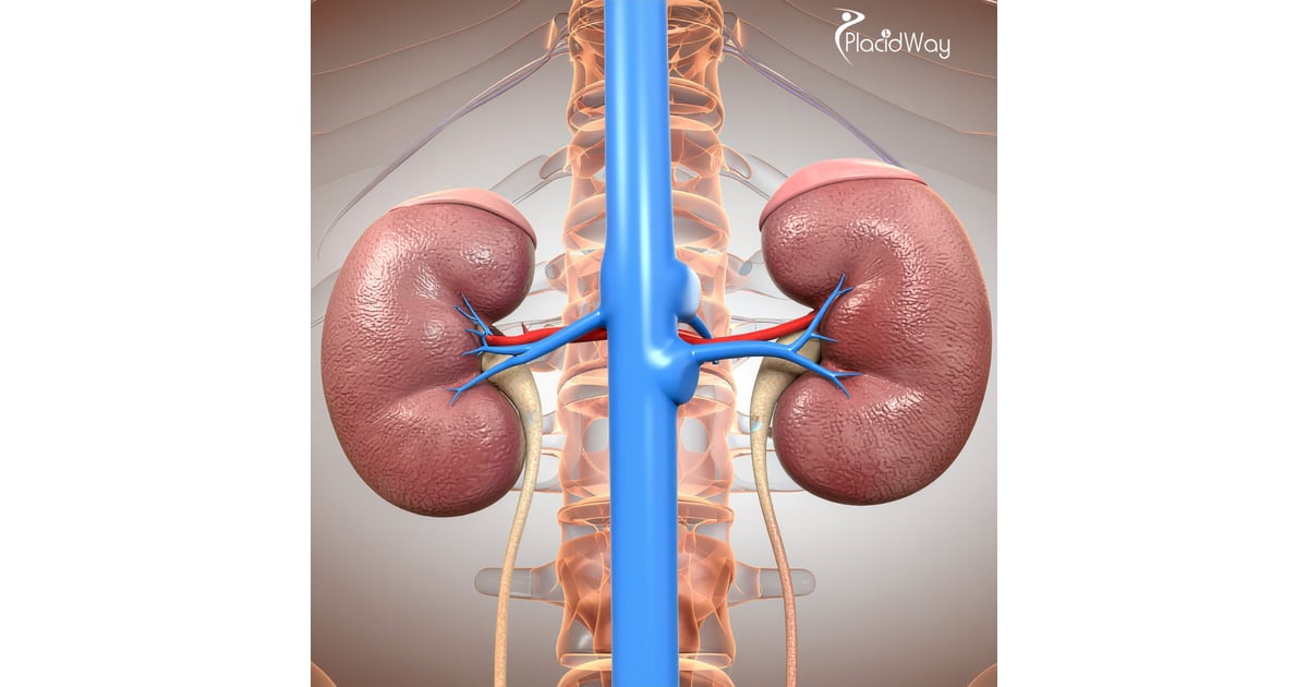 Integrative Kidney Cancer Treatment in Tijuana - Preserving Renal Function