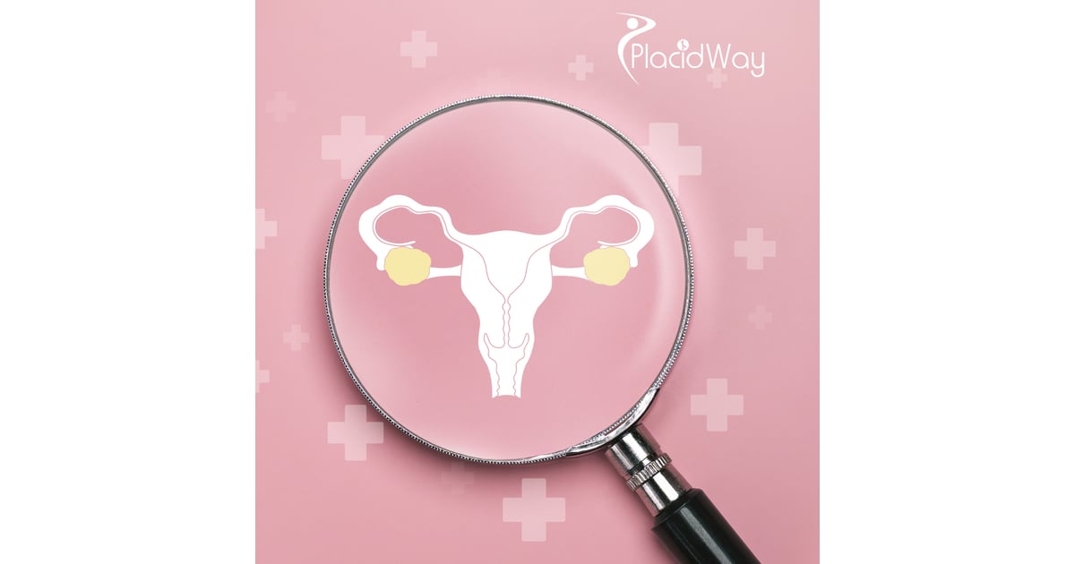 Advanced Ovarian Cancer Treatment in Tijuana - New Hope for Cancer Patients