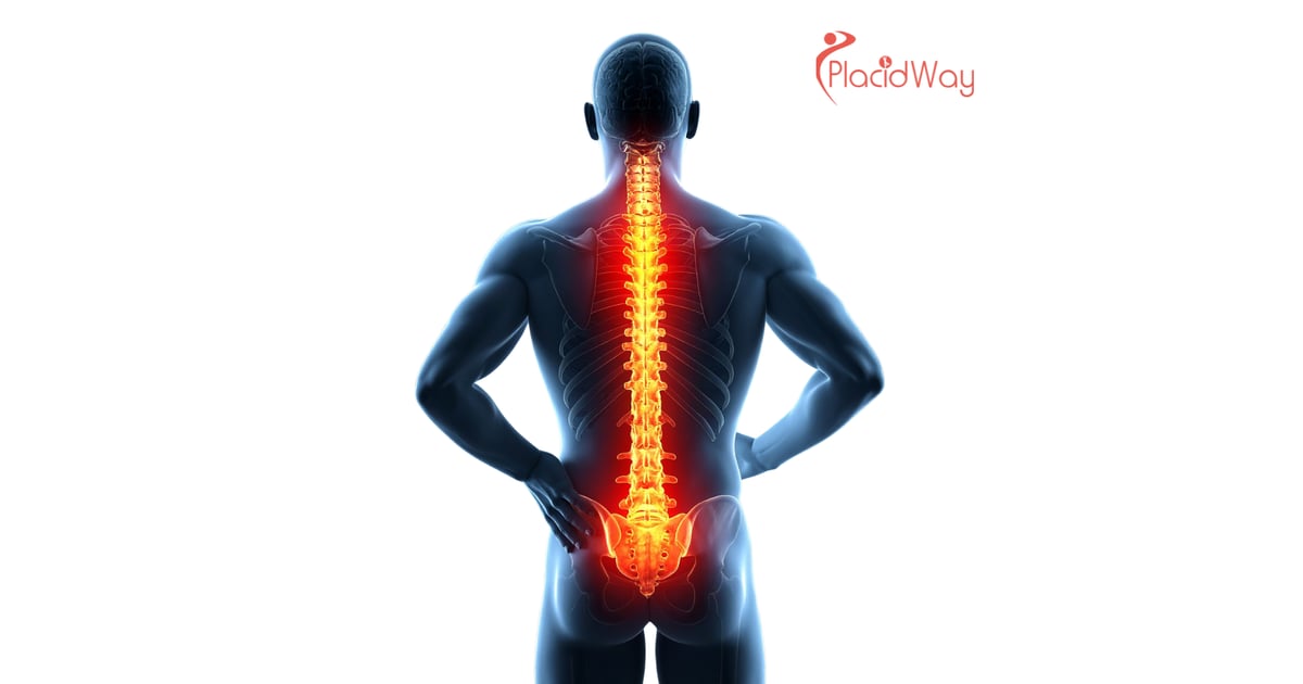 7 Top Benefits of Spine Surgery in Poland