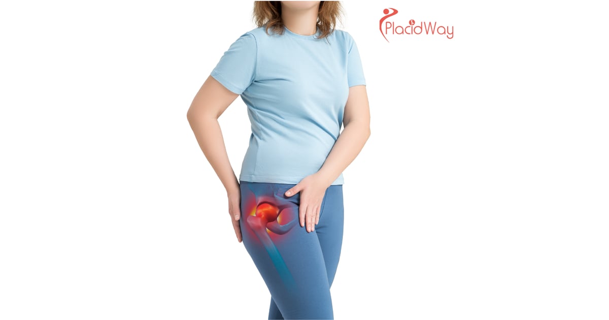 5 Benefits of Hip Replacement Surgery in Warsaw, Poland