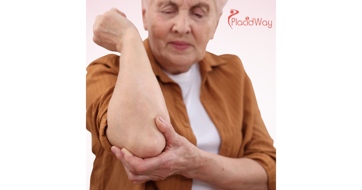 Osteoarthritis Treatment in Mexico: How Stem Cells Are Offering Hope in Guadalajara