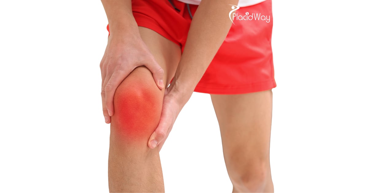 Stem Cell Therapy for Knee Osteoarthritis in Japan: A Regenerative Option for Pain and Mobility