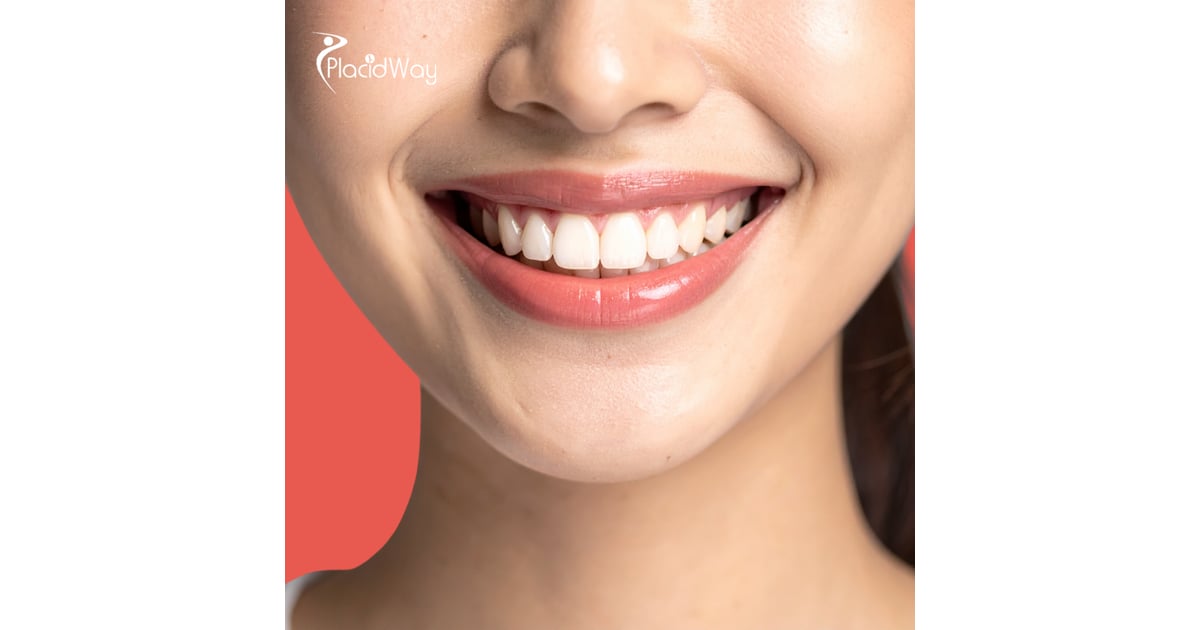Dental Bridges in San Jose, Costa Rica by Top Dentists