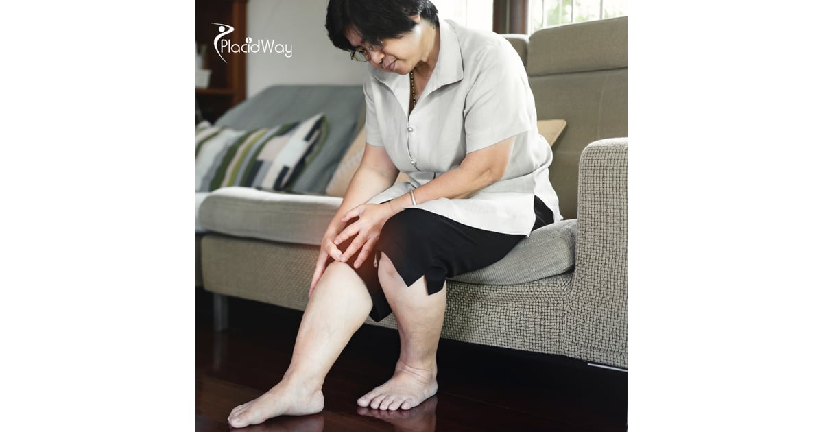 Tratamiento de la osteoartritis con células madre en la clínica MexStemCells: por qué la Ciudad de México es el destino ideal