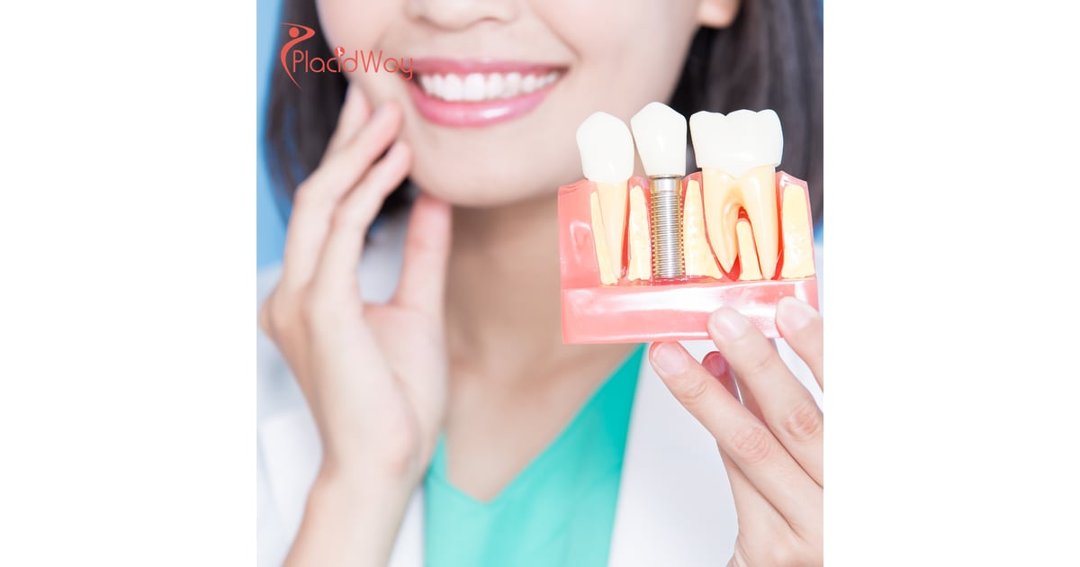 Escaping High Dental Costs: How UK Patients Are Saving Thousands on Implants in Georgia