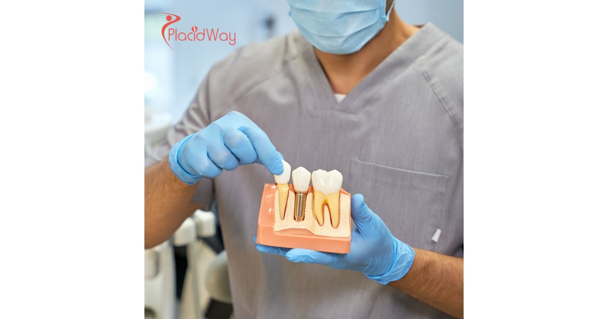 Croatia Set to Overtake Competitors as Italy's Leading Destination for All-on-4 Dental Implants