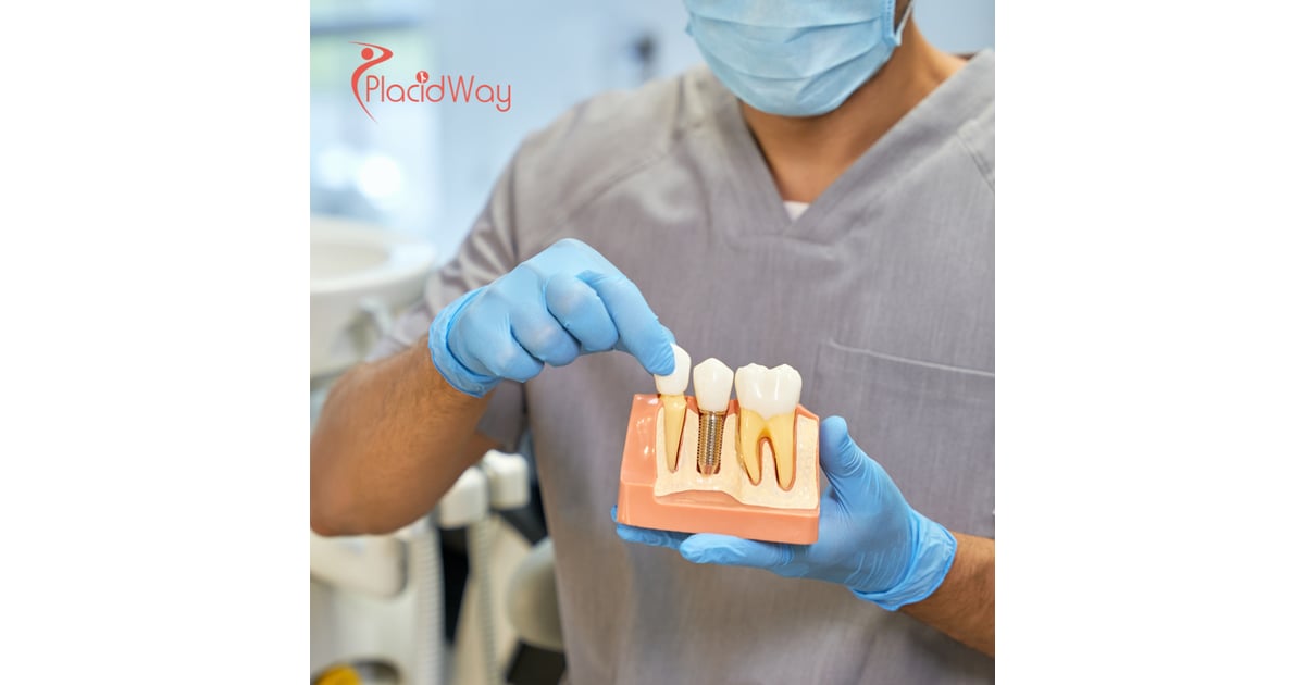 From Almaty to Tbilisi: The Rise of Kazakhstan Patients Seeking Expert Dental Implants in Georgia