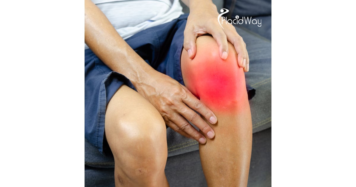 Turkey Set to Emerge as the Top Destination for German Medical Tourists Seeking Affordable Knee Arthroplasty