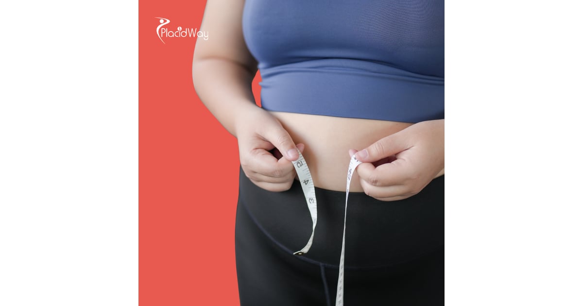 Why Thousands of United Kingdom Patients are Trading NHS Waiting Lists for Gastric Sleeve Packages in Turkey This Year