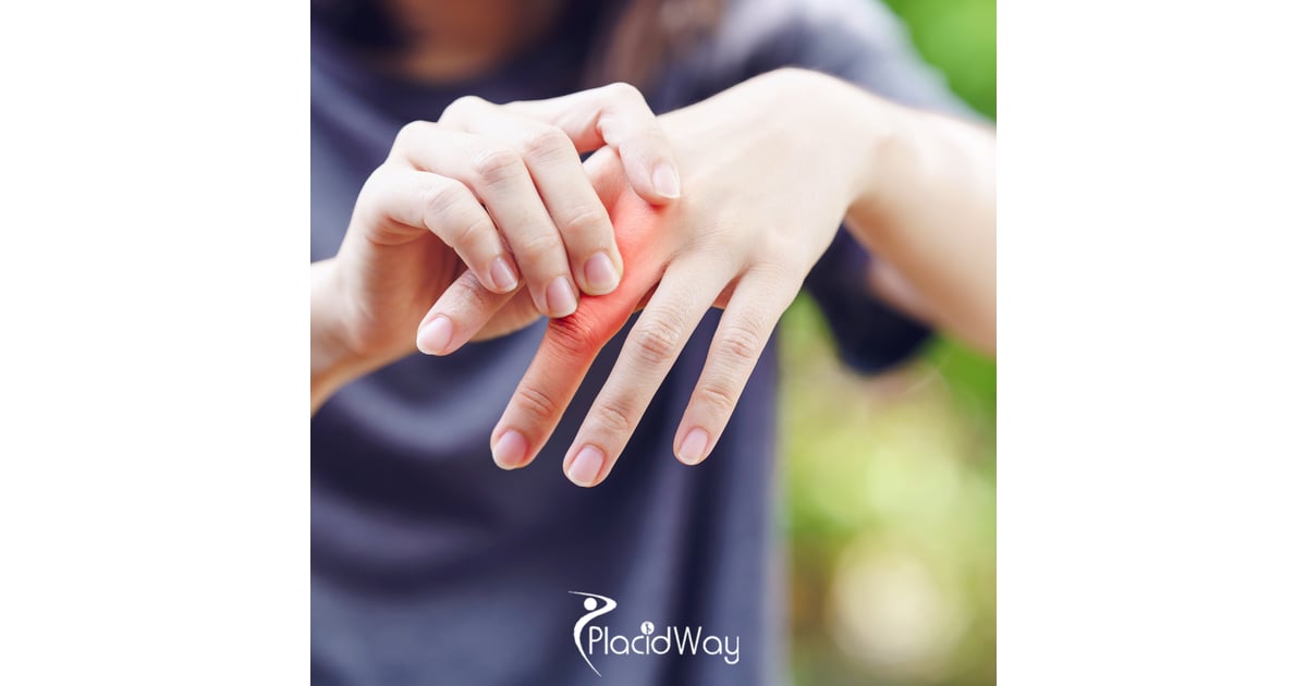 How Stem Cells Are Helping U.S. Patients Find Lasting Relief from Rheumatoid Arthritis