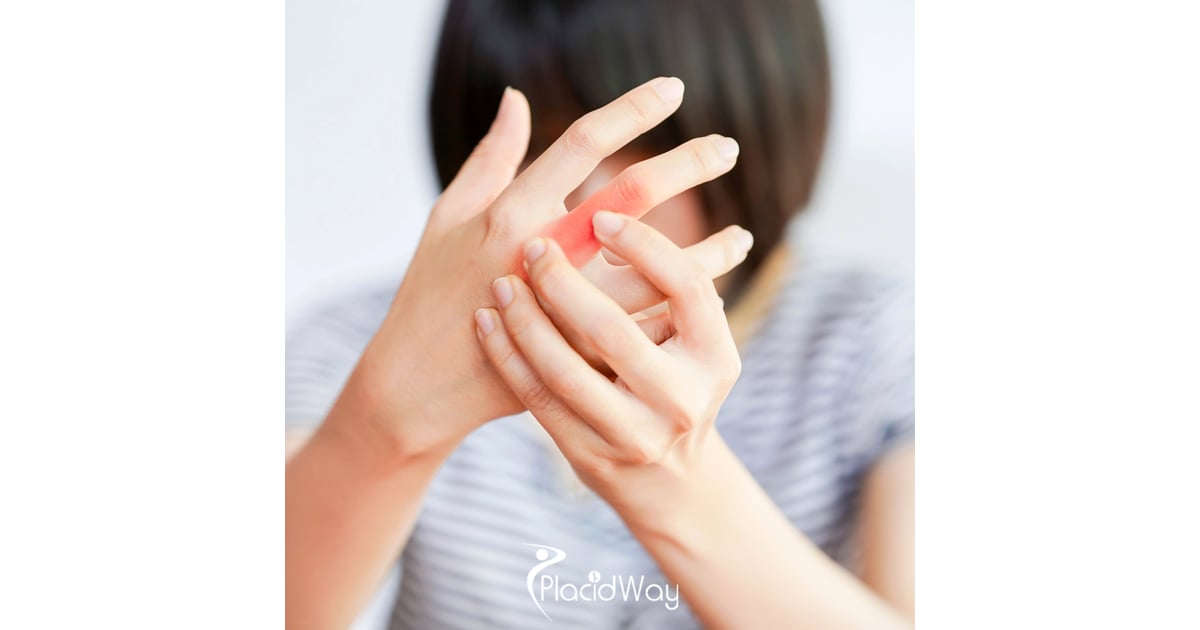 Stem Cells for Autoimmune Diseases: Vietnamese Are Trusting Osaka for Groundbreaking Treatment
