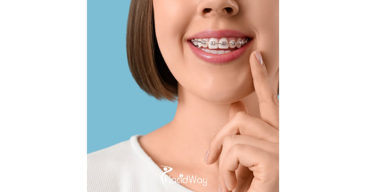 Clear Aligner Tourism: Why Bengaluru is Emerging as the Preferred Hub for Western Digital Nomads Seeking High-Tech Orthodontic Correction