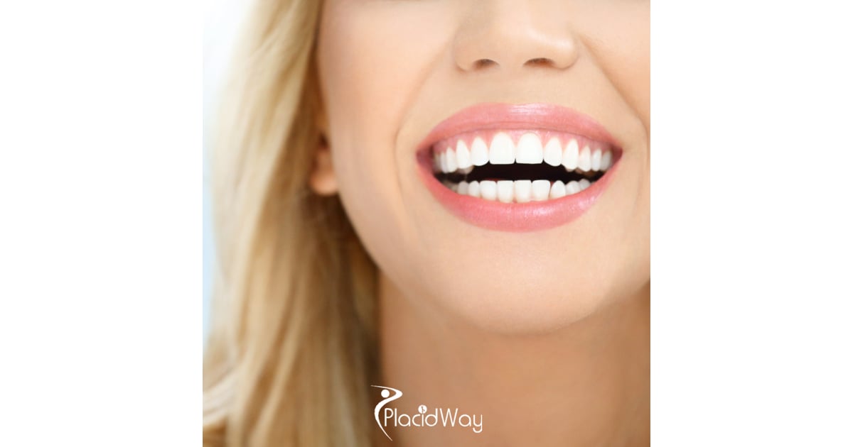 The 'Saigon Smile': How 2026's AI-Powered Digital Smile Design is Attracting a Record Number of UK and European Patients Seeking Hollywood Veneers