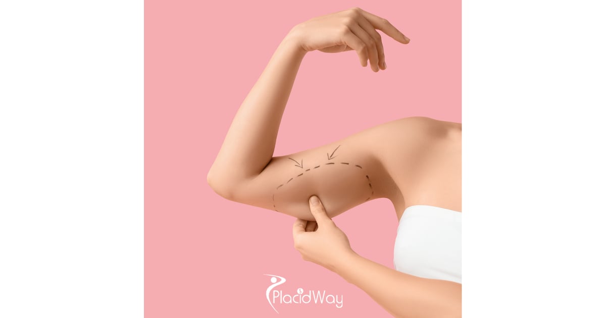 High-Tech Body Contouring: Why Guadalajara is Leading the VASER Liposuction Boom in 2026
