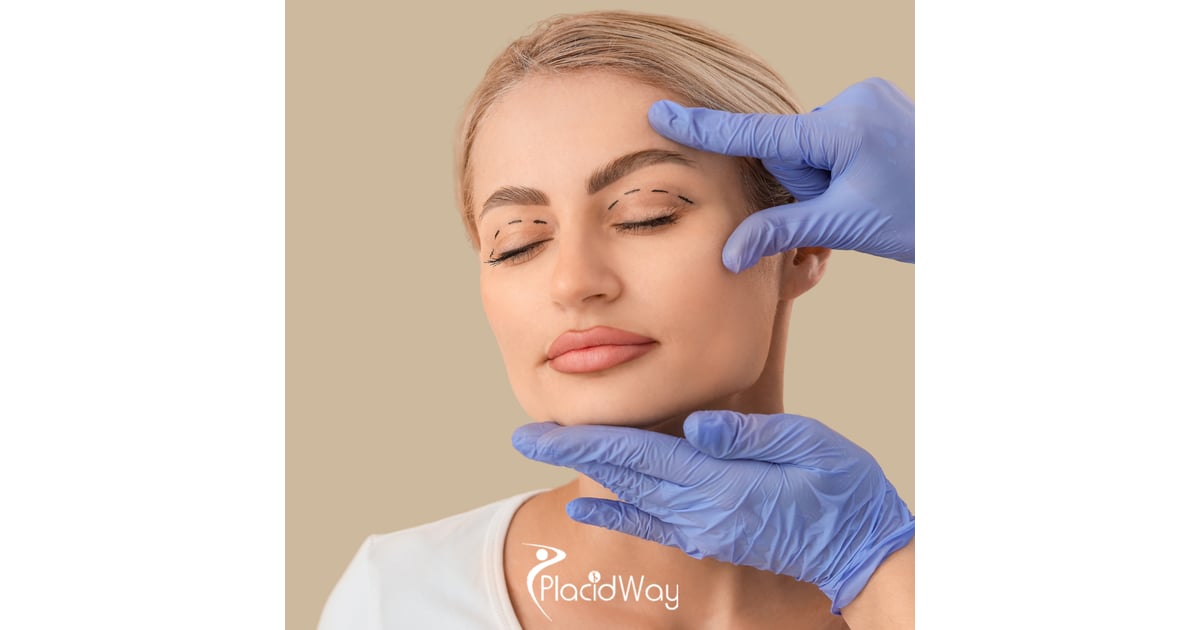The Subtle Refresh: Why Guadalajara is the Go-To Hub for Quick-Recovery 'Fox Eye' and Eyelid Surgeries