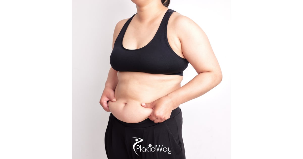 No Incisions, No Hospital Stay: The Rise of the 'Drive-In' Gastric Balloon in Piedras Negras